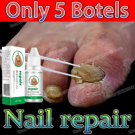 Toenail Nail Fungus