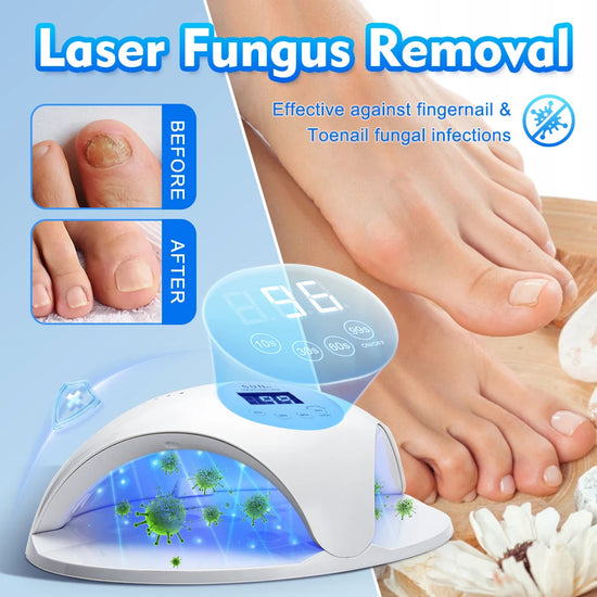 Fungal Nail Laser Device Repair