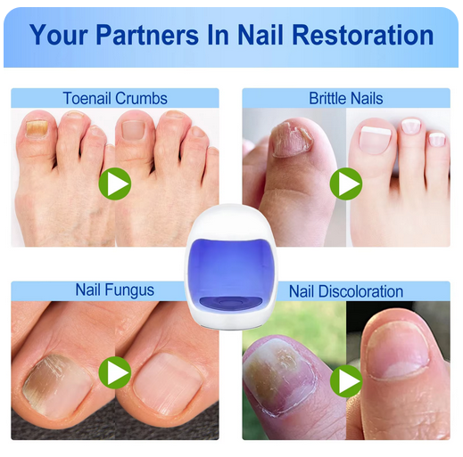 SAY BYE TO NAILS FUNGUS